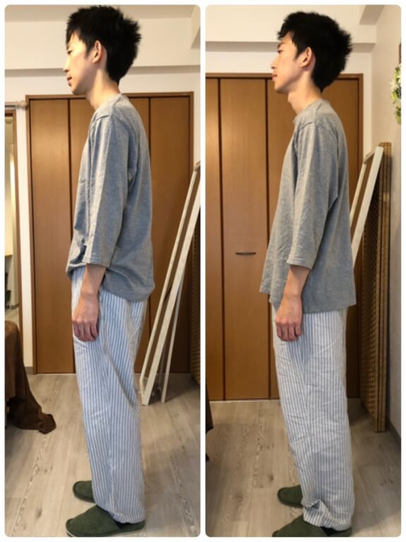 姿勢矯正・猫背矯正のビフォーアフター・板橋区２０代男性の写真